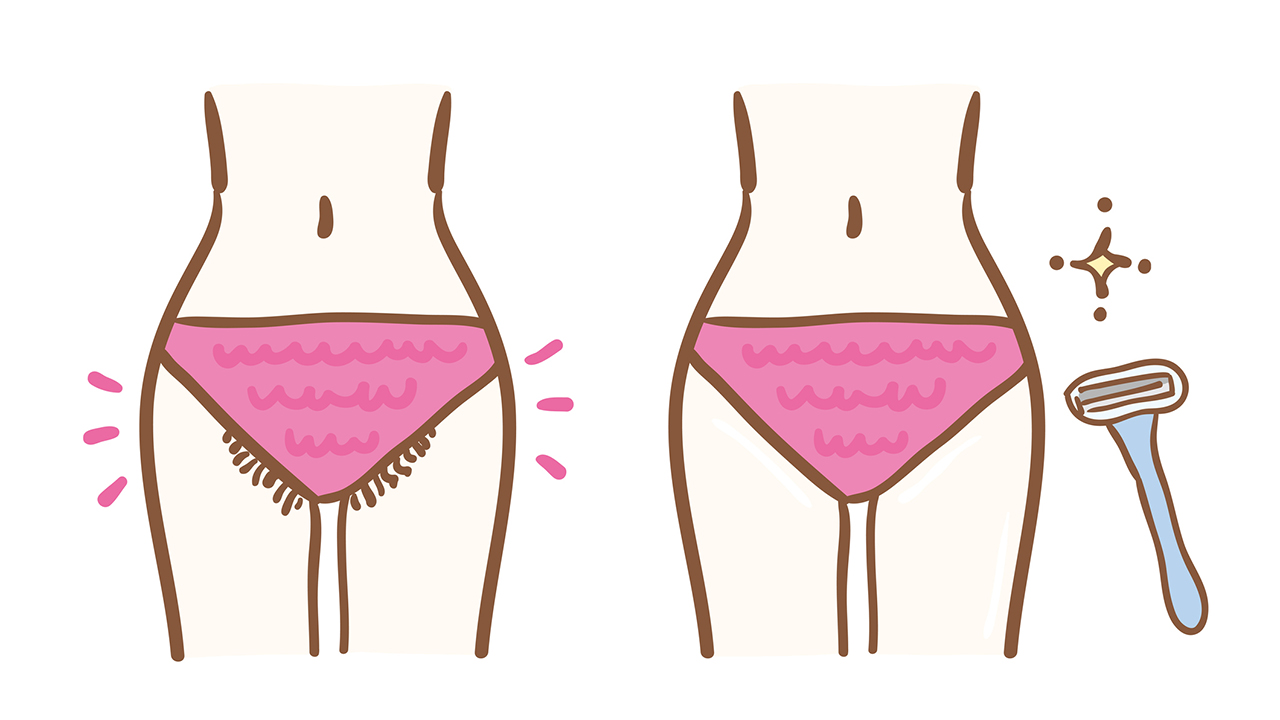 Rajz két női testről, melyen rózsaszín bikini van, az egyik szőrtelenítés előtt, a másik utána készült.