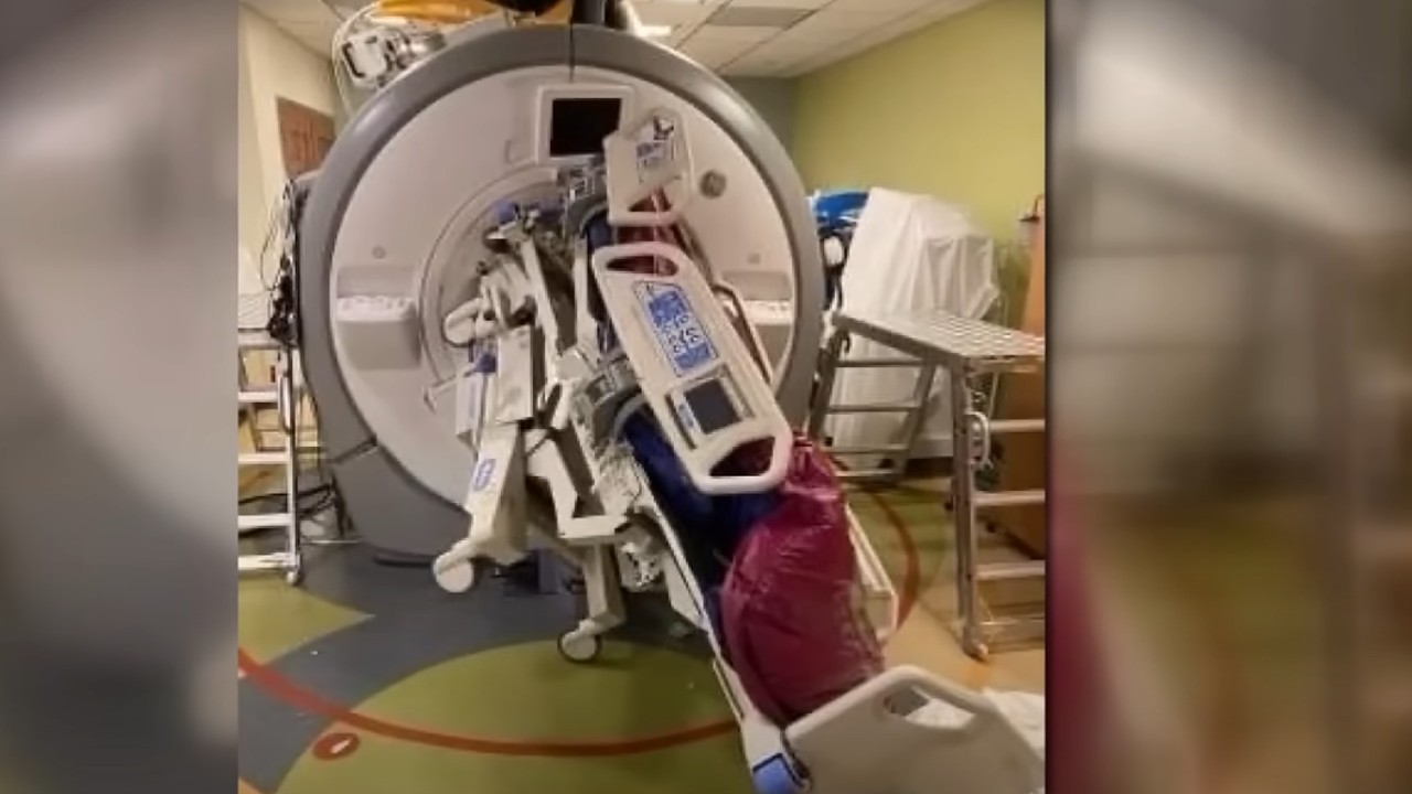MRI-gép szippantotta magába az ápolónőt.