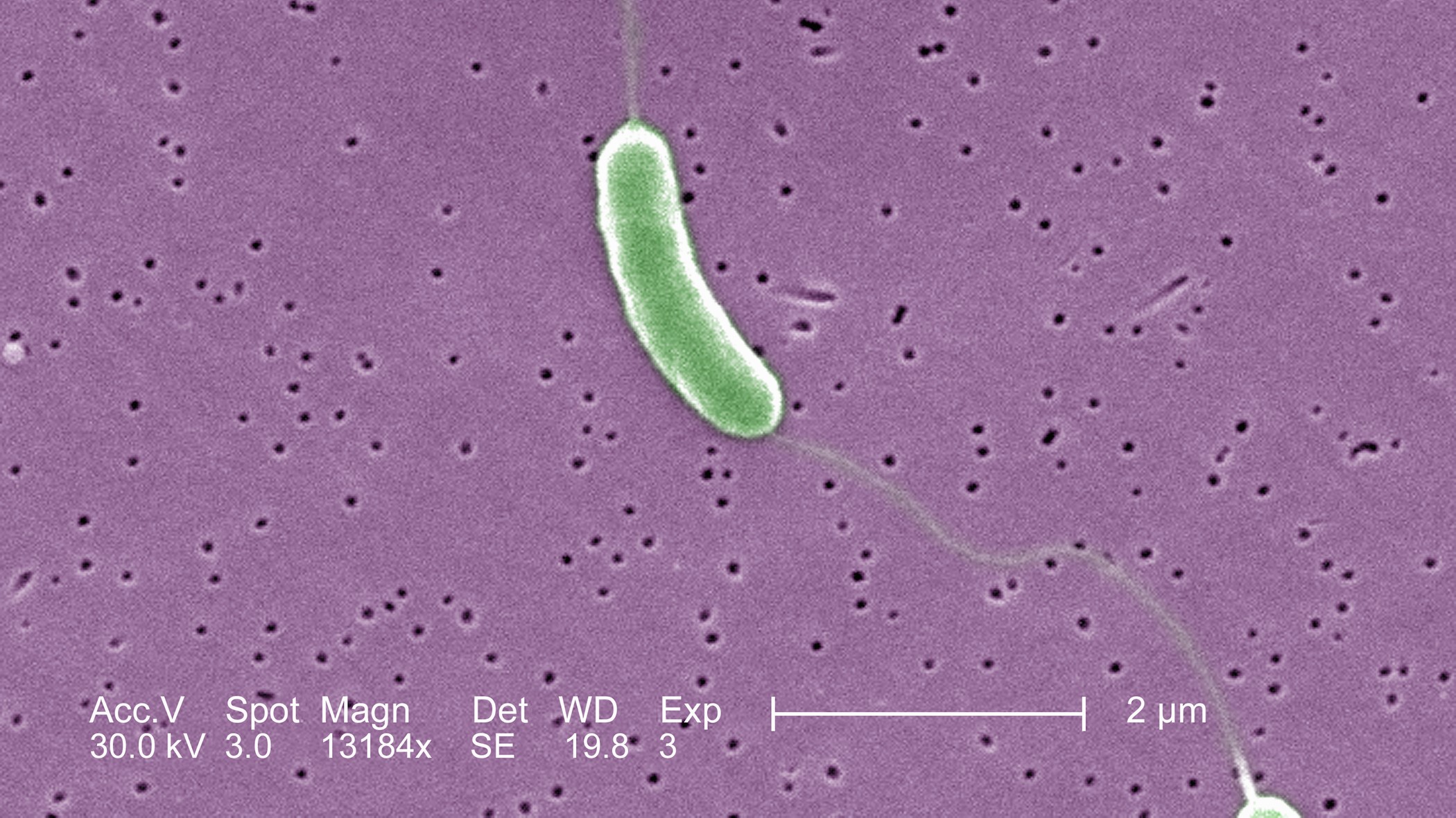 Vibrio vulnificus baktérium