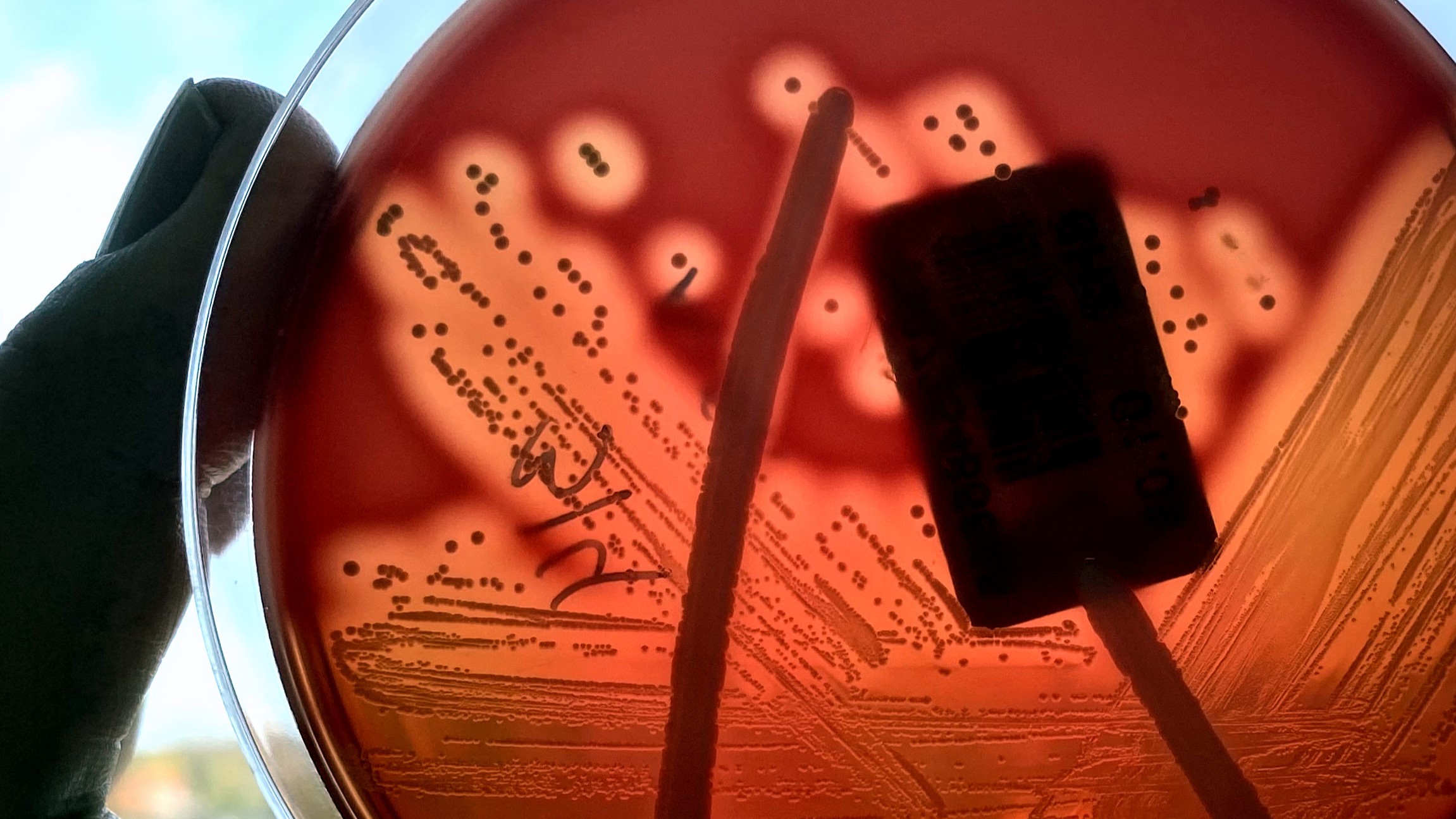 Baktériumtelepek egy Petri-csészében.