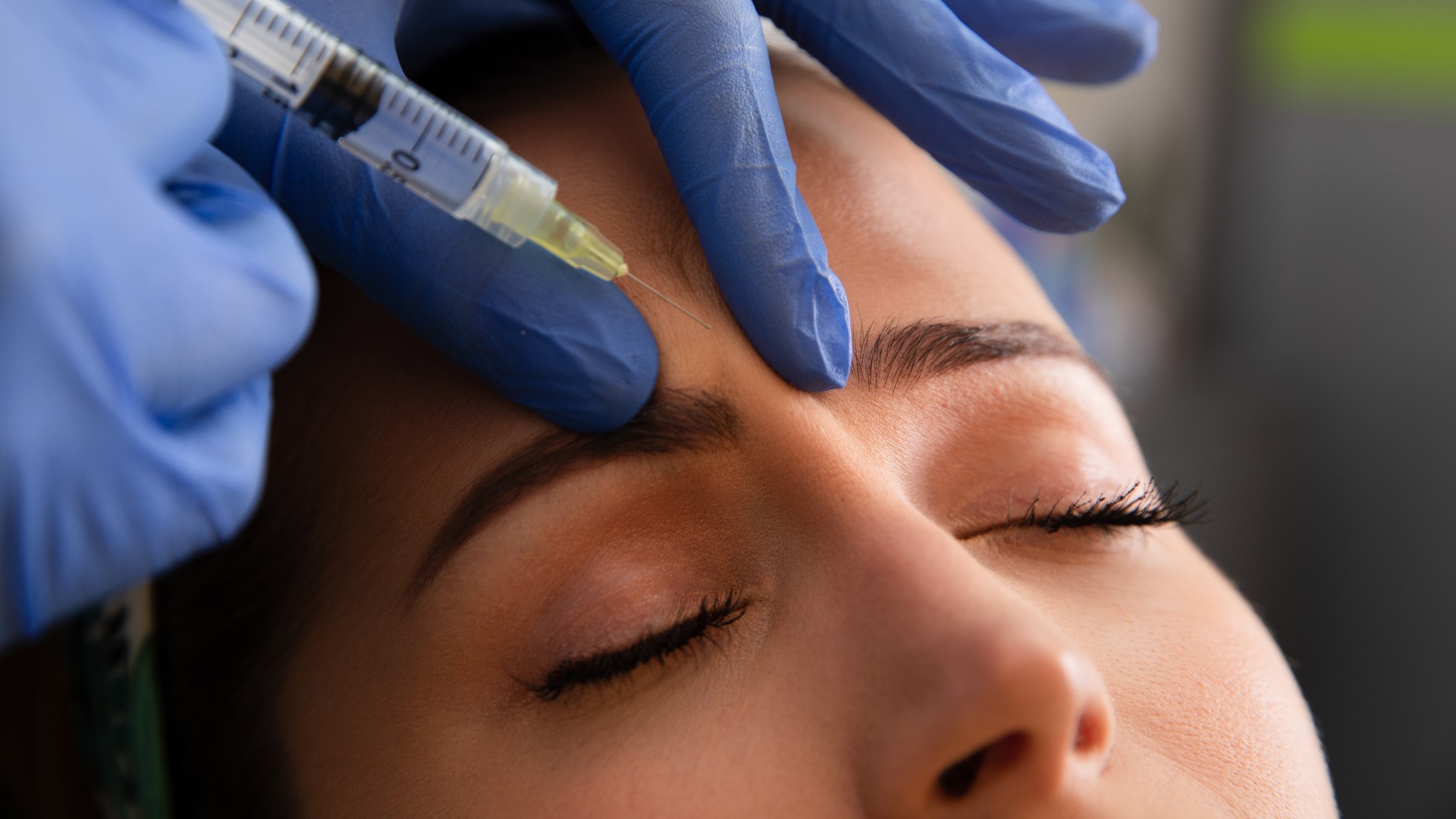 Botoxot injekcióznak egy nő homlokába