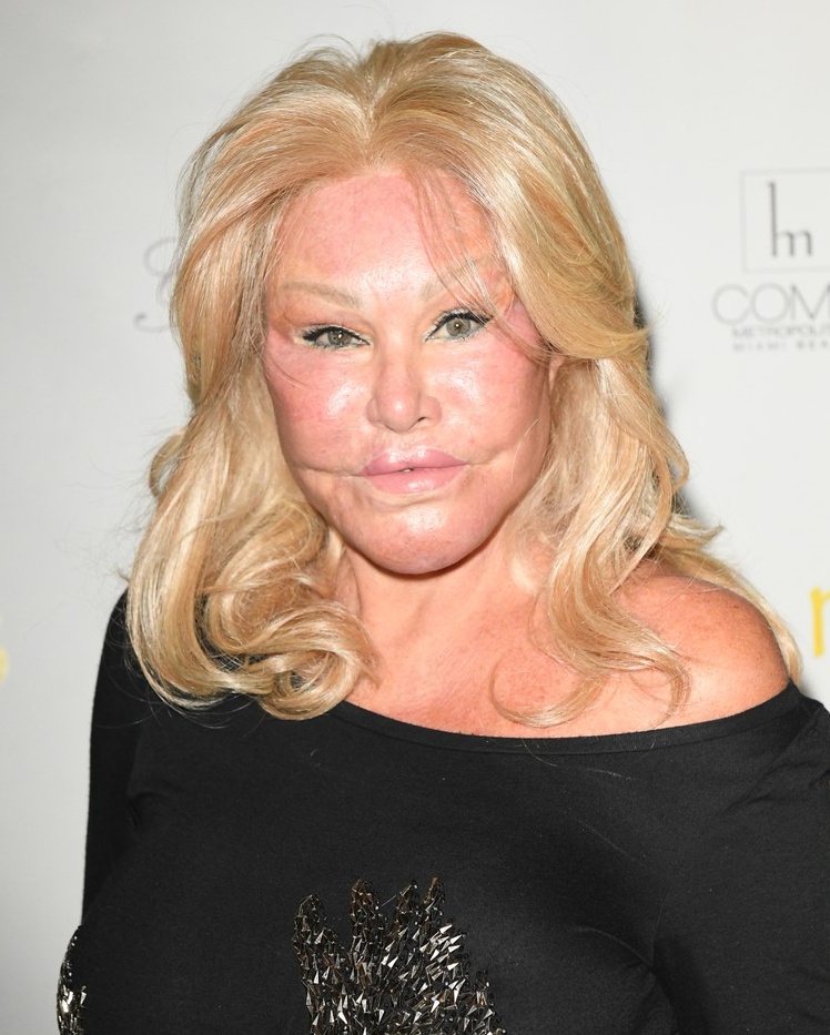 Jocelyn Wildenstein 