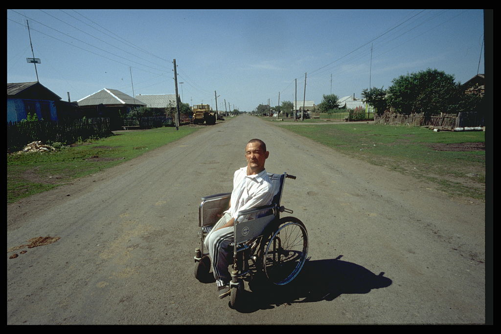 (Original Caption) Mental defective in a street in Muslumovo village. (Photo by Antoine GYORI/Sygma via Getty Images)